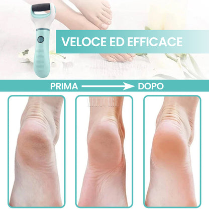 Pedicure Elettrico Rosa - È BELLO CIÒ CHE PIACE